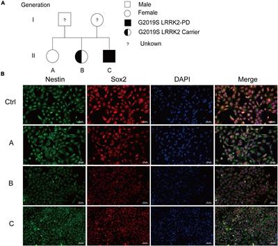 G2019S LRRK2 Mutation Enhances MPP+-Induced Inflammation of Human Induced Pluripotent Stem Cells-Differentiated Dopaminergic Neurons